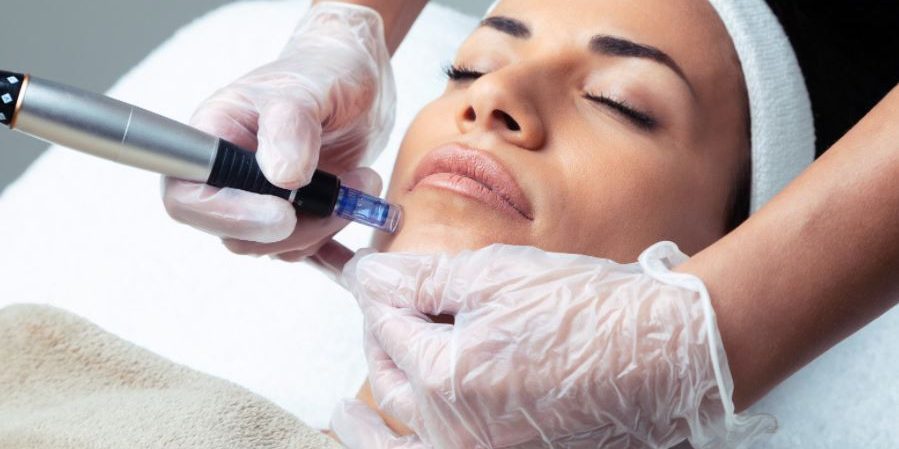 Dermapen + Mesoterapia